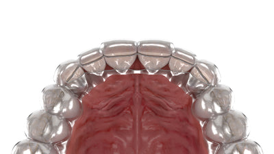 New Maintain Webinar Hosted by Consultant Orthodontist David Waring