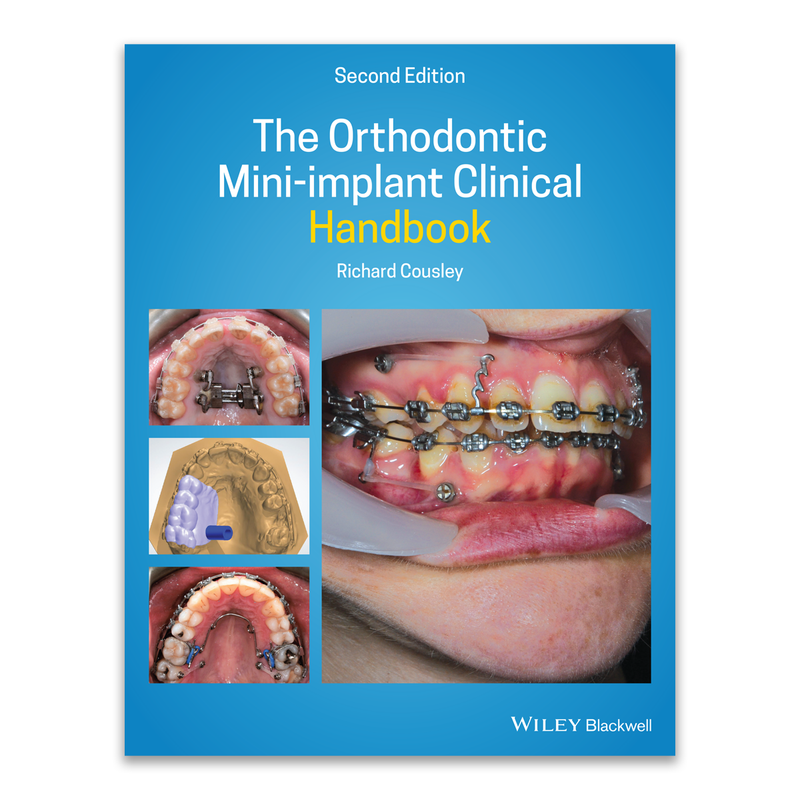 The Orthodontic Mini-implant Clinical Handbook  - Second Edition by Dr Richard Cousley