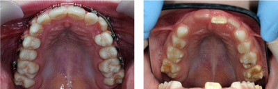 How to Take the Best Dental Clinical Photograph