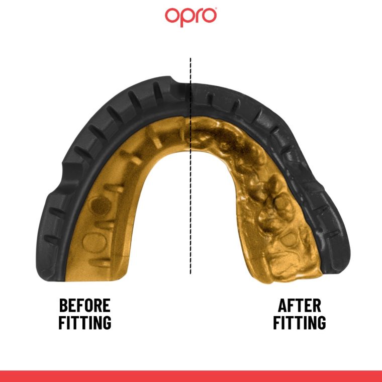 OPRO Self-Fit - Gold Braces