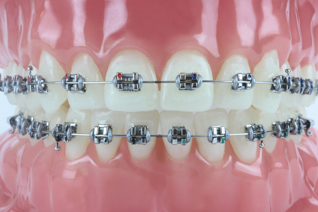 Consultant Model with Half Standard and Half Mini Evolve Stainless Steel Brackets