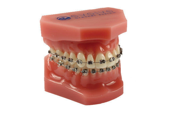 Consultation Model with Evolve Low Profile Stainless Steel Brackets