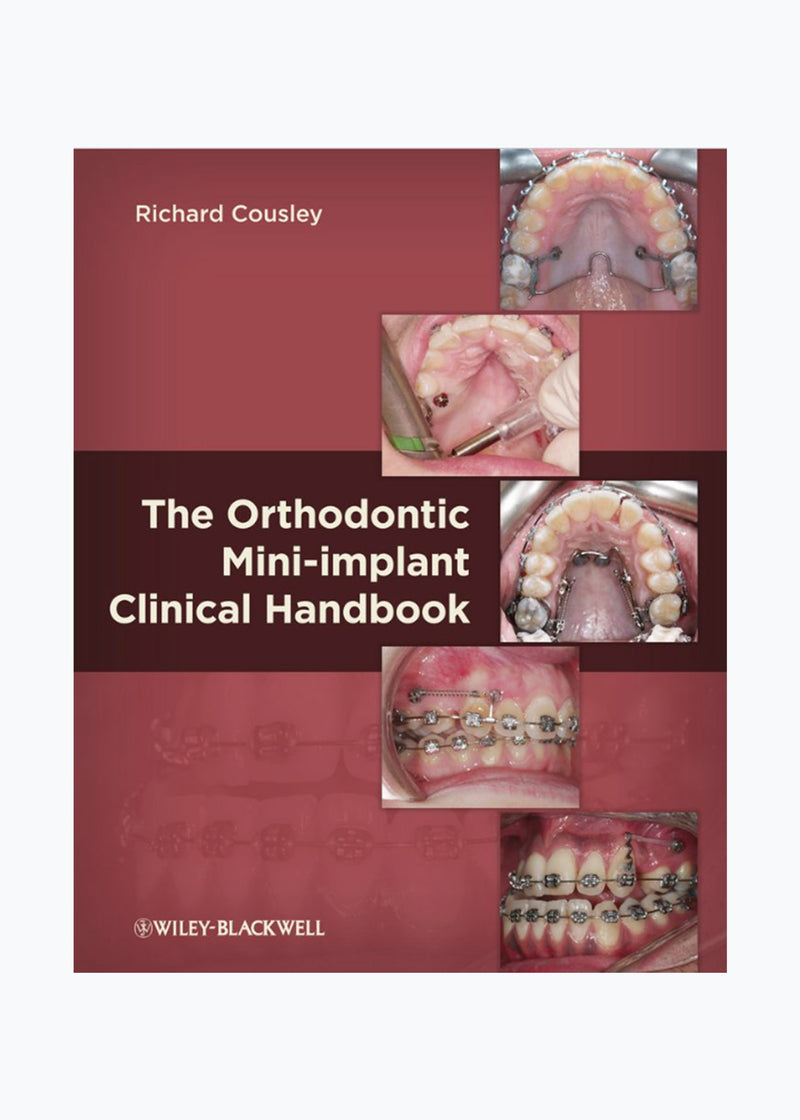 The Orthodontic Mini-Implant Clinical Handbook by Dr Richard Cousley