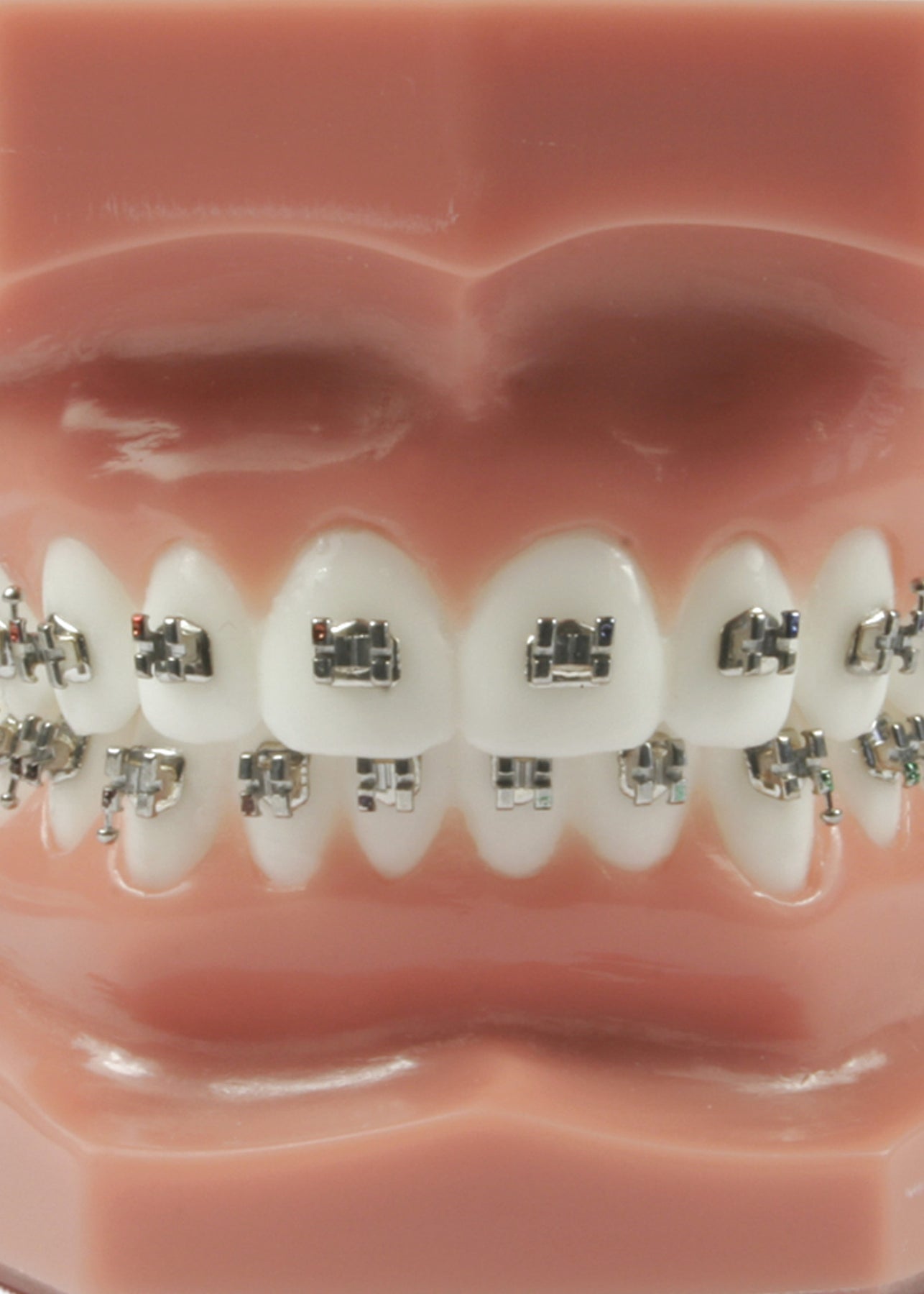 Evolve Mini Brackets - Case Kit – DB Orthodontics Limited
