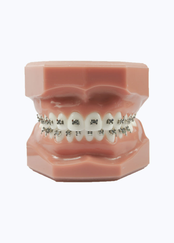 Evolve Brackets - Case Kit
