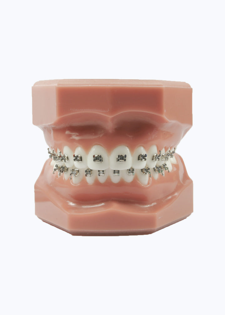Evolve Brackets - (Packs of 10) .018