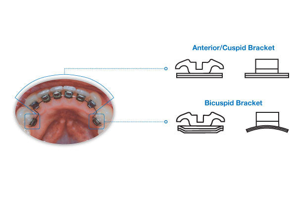 Ideal Brackets